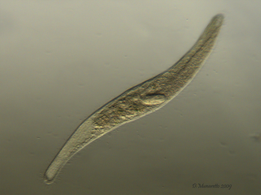 Spirostomum